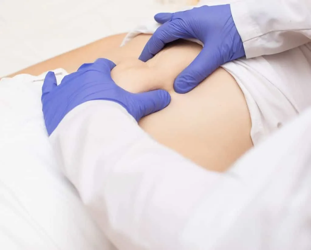 Hiatal hernia surgery