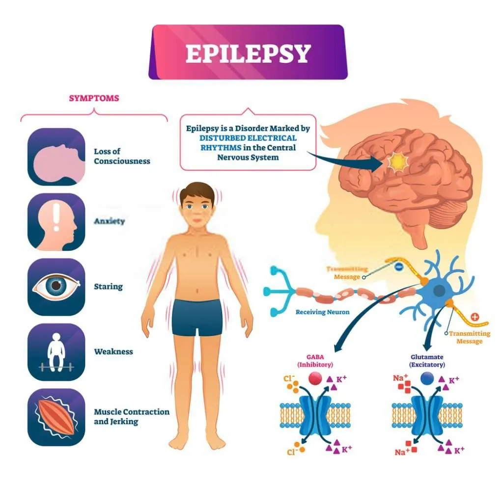 epilepsy