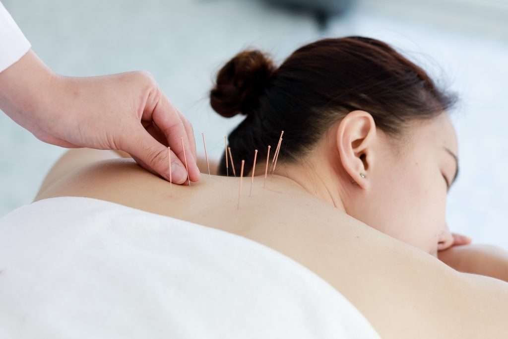 can acupuncture help with diabetes