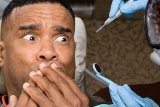 Can You Get Braces If You Have Cavities? Well, It Depends on Your Dental Health and Hygiene