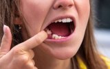 Tooth Extraction Blood Clot Fell Out: 3 Quick Remedies