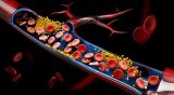 How to Improve Blood Circulation in Diabetes Naturally