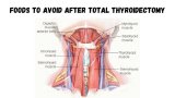 4 Foods To Avoid After Total Thyroidectomy: A Complete Guide