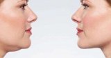 How to Lose Fat from Face and Neck Easily and Effectively
