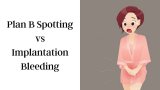 Plan B Spotting vs Implantation Bleeding: Know Your Facts
